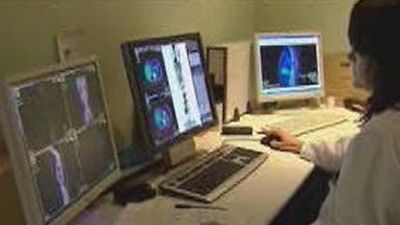 Una red social para analizar tumores on line