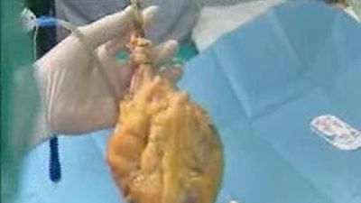 Nace en el Gregorio Marañón el primer laboratorio para crear órganos bioartificiales para trasplante