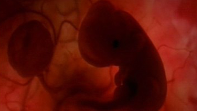 La cifra de abortos cae un 4% en 2009, por primera vez en una década