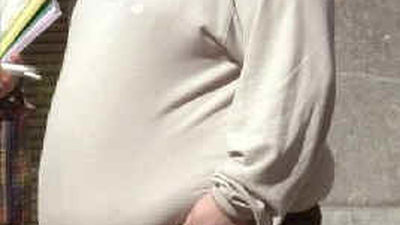 Los hombres obesos tienen alto riesgo de cáncer de próstata