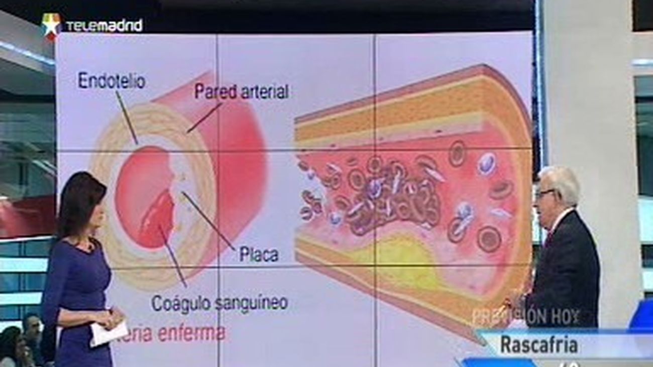 Respuestas a los espectadores