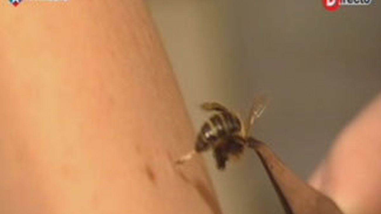 Acupuntura con abejas