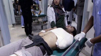 Tres muertos y 150 heridos en ataques de la OTAN en Trípoli, según el régimen