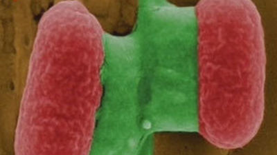 La OMS afirma que el desconocimiento de la nueva  cepa de 'E.coli' va a dificultar su control