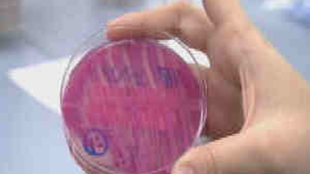 Bacteria E-coli