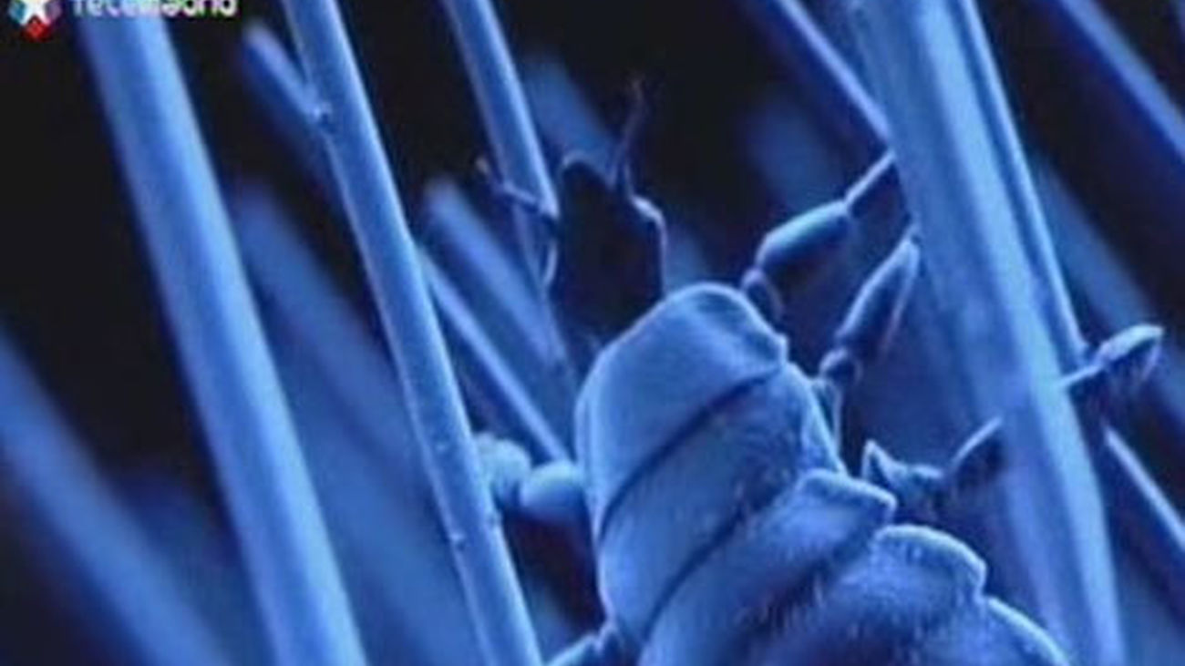 Cómo tratar y prevenir los piojos