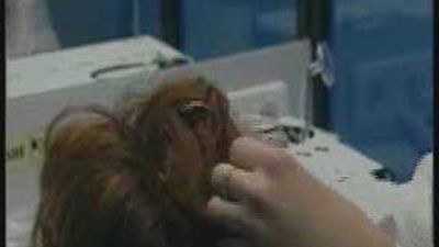 La OCU denuncia el "engaño" de los tratamientos contra la alopecia