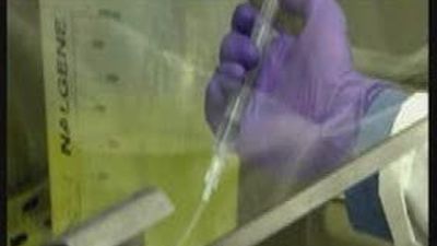 Linfocitos genéticamente modificados exterminan tumores de leucemia