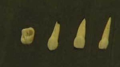 Los restos del primer neandertal de la región descubiertos en el  yacimiento del Calvero