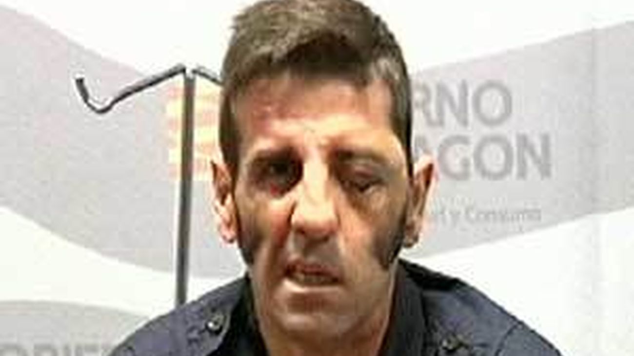 El torero Padilla afirma que volverá a la plaza