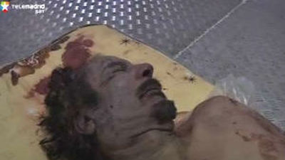 Gadafi murió por un disparo en la cabeza, según el forense