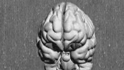 Un mapa en 3D del cerebro para trazar la ruta del Alzheimer