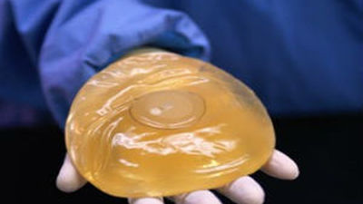 Encarcelan en Francia al fabricante de los implantes mamarios defectuosos PIP