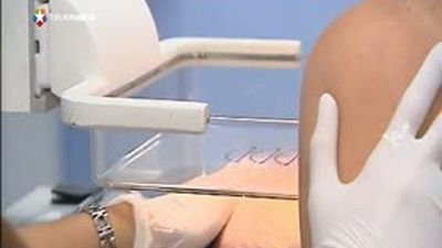 El Hospital del Sureste pone en marcha la unidad de tratamiento integral de cáncer de mama