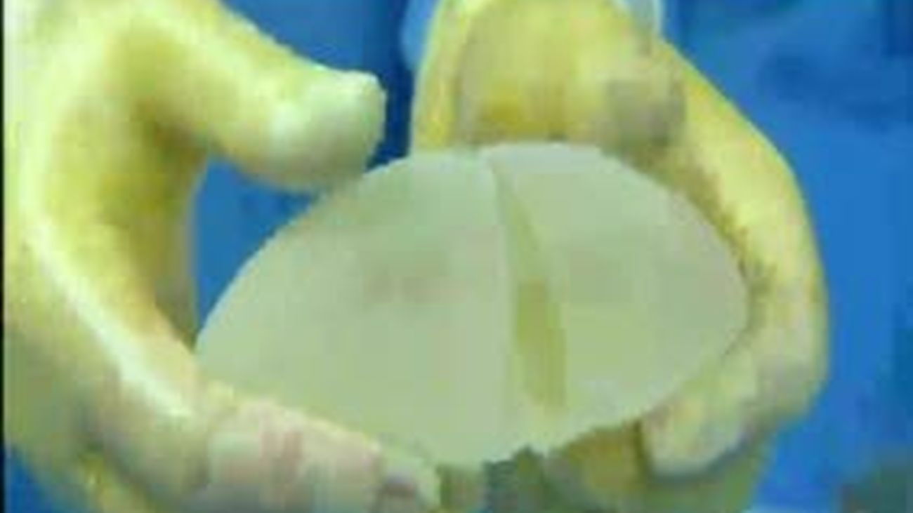 Hablamos sobre las prótesis mamarias PIP: ¿las mujeres están protegidas?