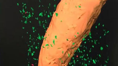 Mapas microscópicos del cerebro permitirán buscar fármacos para el alzhéimer