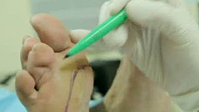 Se acabó el dolor de pies