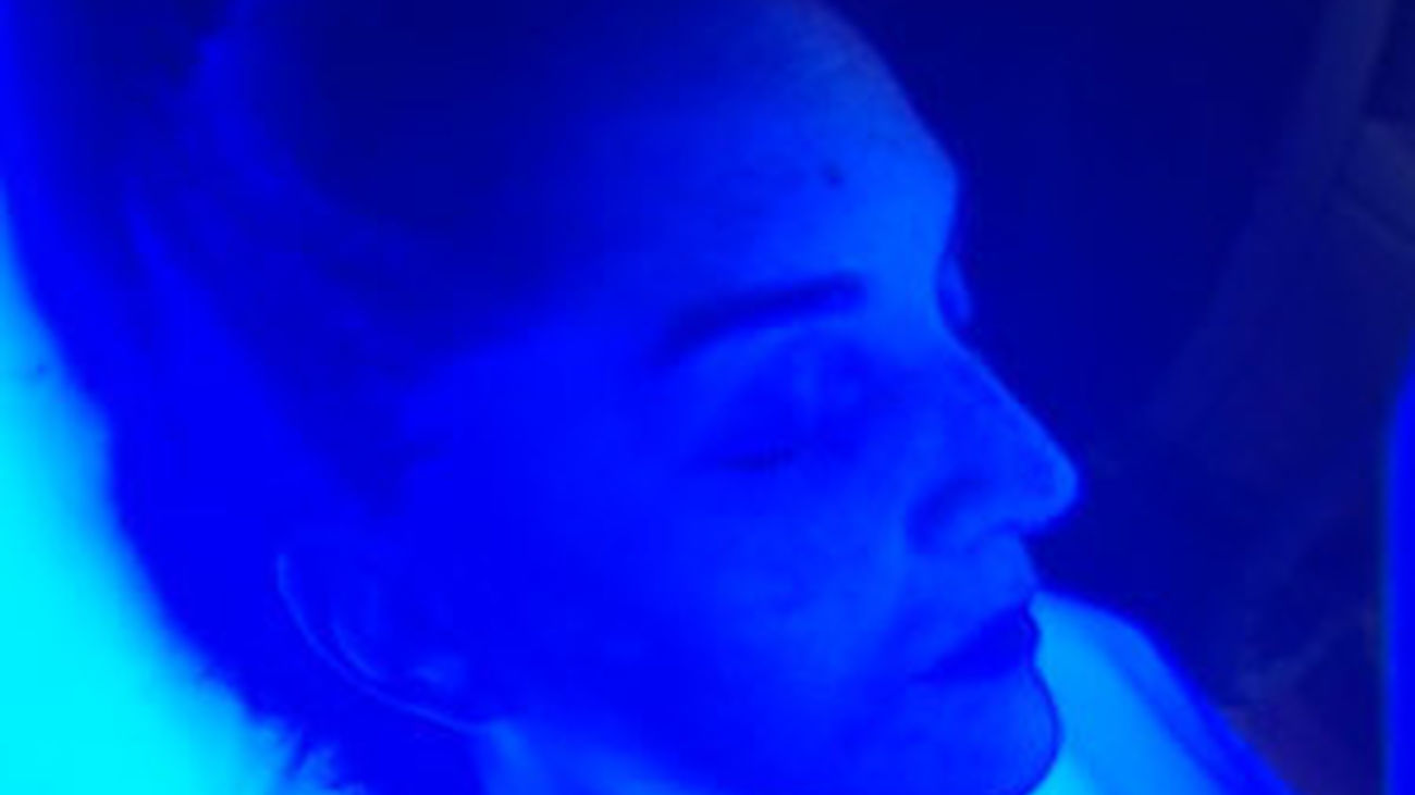 Adiós a las manchas en la piel