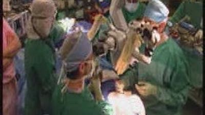 Realizado en EEUU el trasplante de cara mas completo del mundo