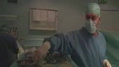 Polémica en el Reino Unido por las prótesis PIP