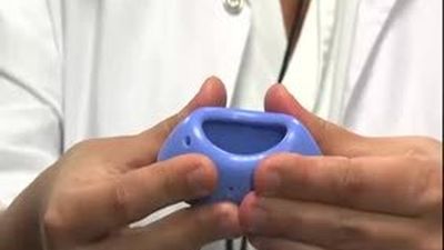 La inserción de un anillo en el útero reduce en un 75% los partos prematuros