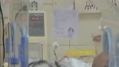 La bebé "milagro" argentina, se aferra a la vida