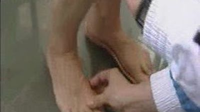 El pie es el gran olvidado de los maratonianos