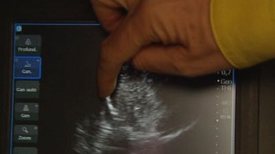 Herido muy grave un hombre tras recibir puñalada en el corazón en Madrid