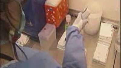 Descubierta la molécula que propaga el Sida