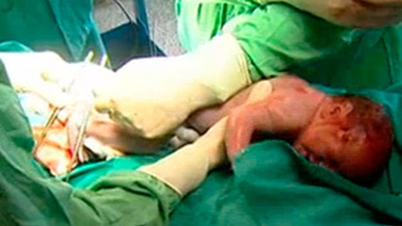 Aumentan los bebés prematuros