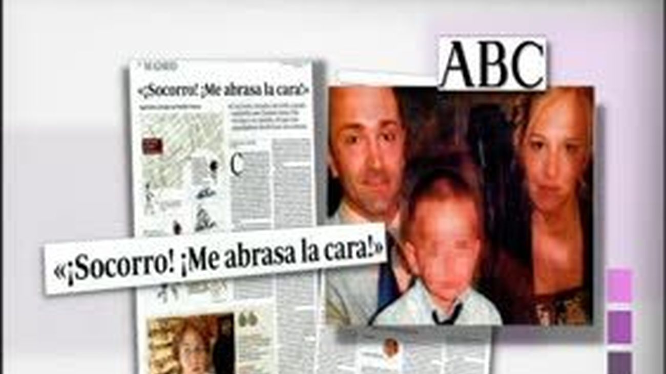 El drama de Mª Ángeles, la mujer rociada con ácido