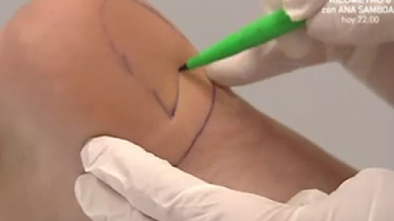 Más altos con plantillas inyectables