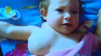 Una operación a medio nacer