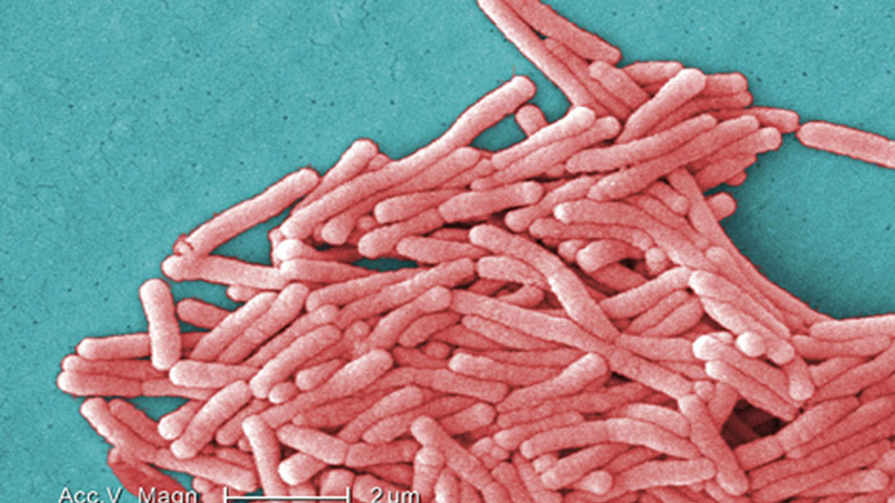 Legionella_pneumophila
