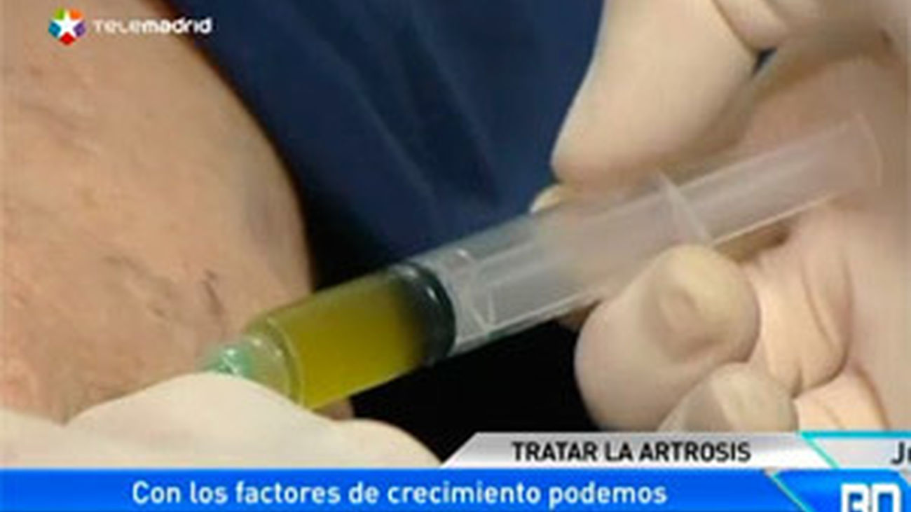 La regeneración de las articulaciones