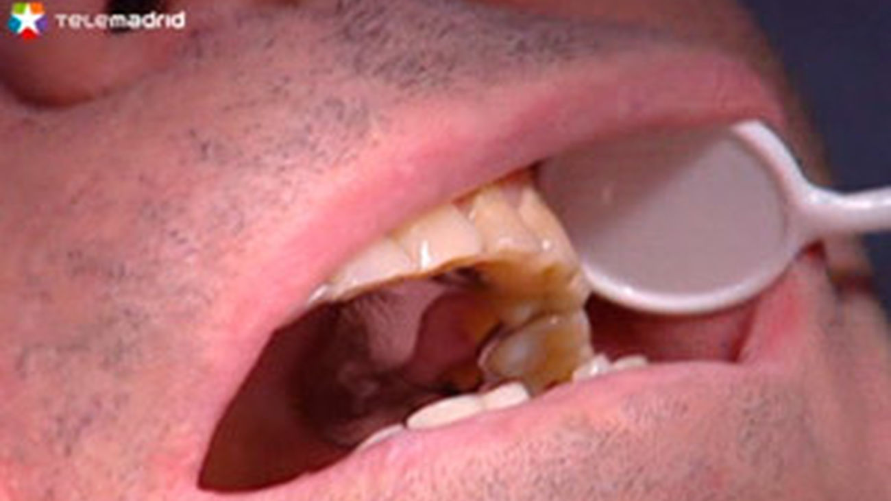 Bruxismo y halitosis