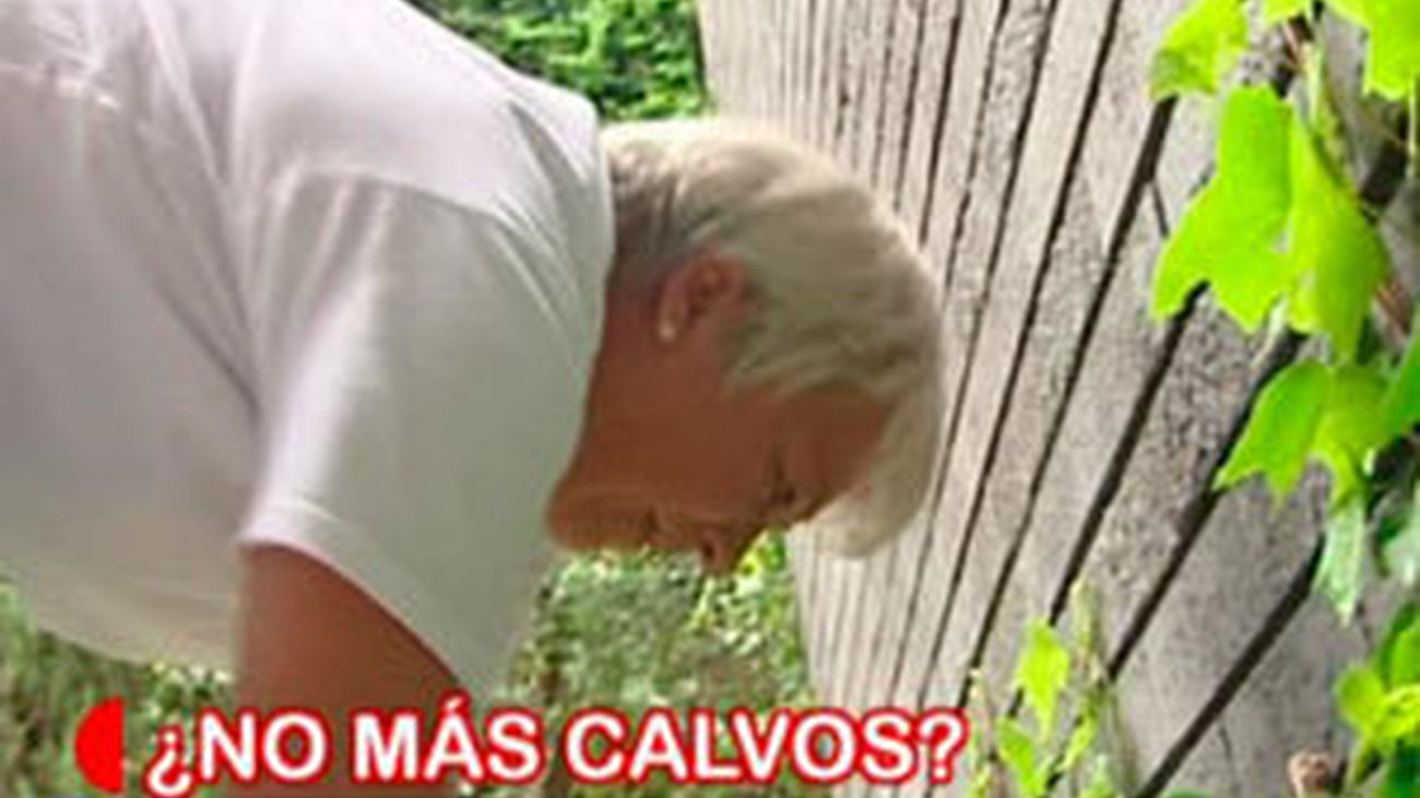 La calvicie tiene solución