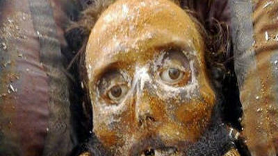 Los científicos constatan que las balas no afectaron órganos vitales Prim