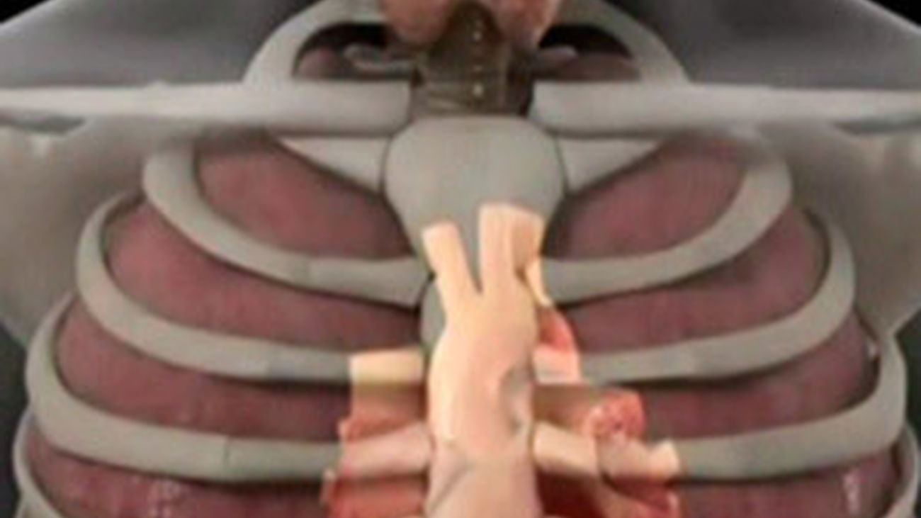 ¿Cómo se produce la muerte por aplastamiento?