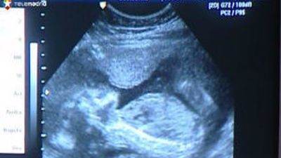 Los fetos bostezan en el útero