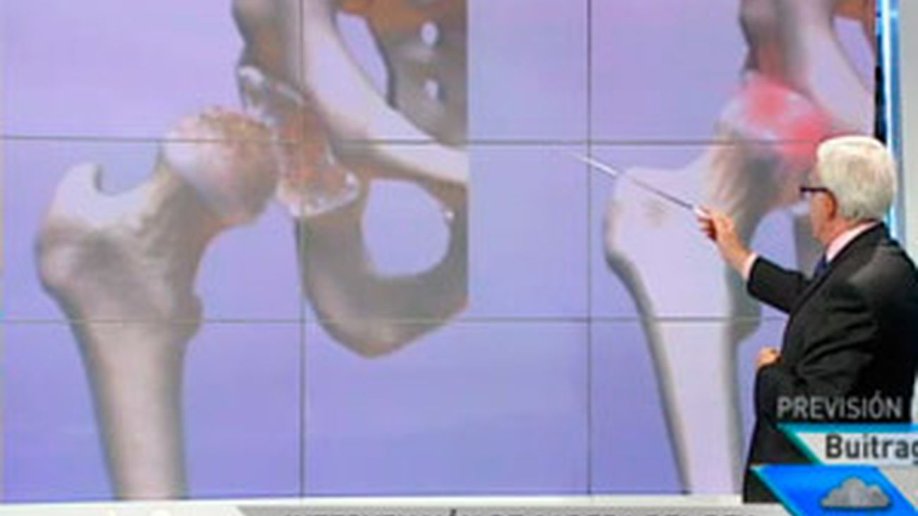 La operación de cadera del Rey