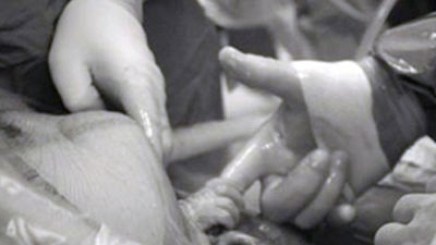 Éxito en Internet de una foto del nacimiento de un bebé agarrando la mano del médico