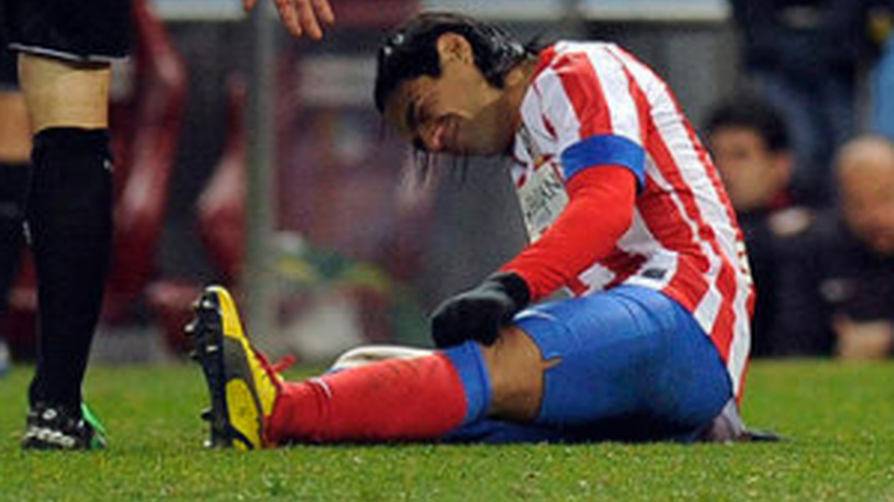 Falcao no está roto