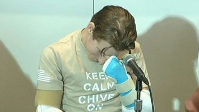 Un soldado estadounidense recibe un doble trasplante de brazos