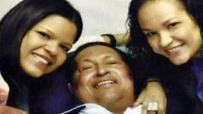 Chávez respira a través de una cánula traqueal