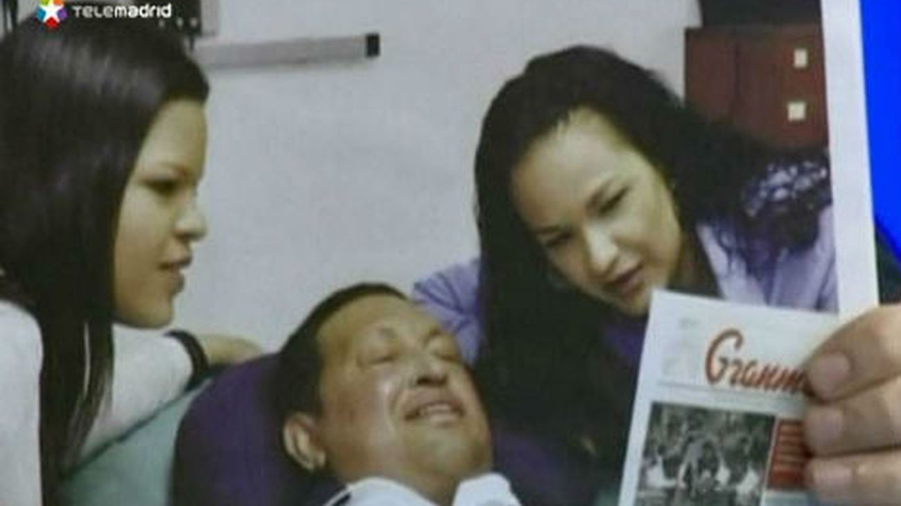 Chávez sufre insuficiencia respiratoria y no evoluciona favorablemente