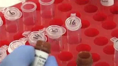 El cáncer supuso un costo de más de 126.000 millones para la UE en 2009