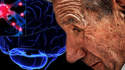 Nuevo protocolo para detectar al Parkinson, que afecta a 11.000 madrileños