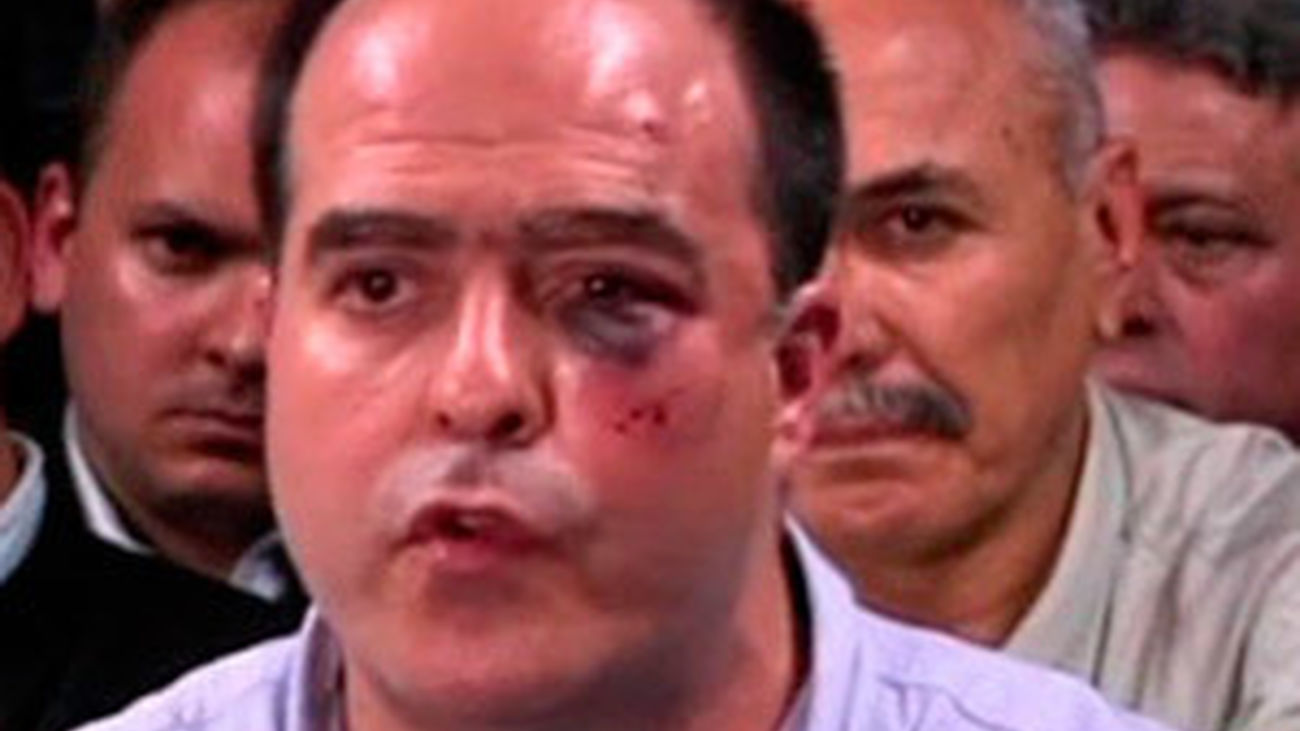 Salvaje agresión política en Venezuela