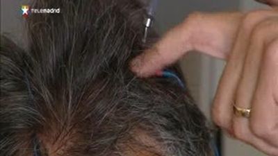 Presentan un robot que permite operar epilepsias que no tenían tratamiento